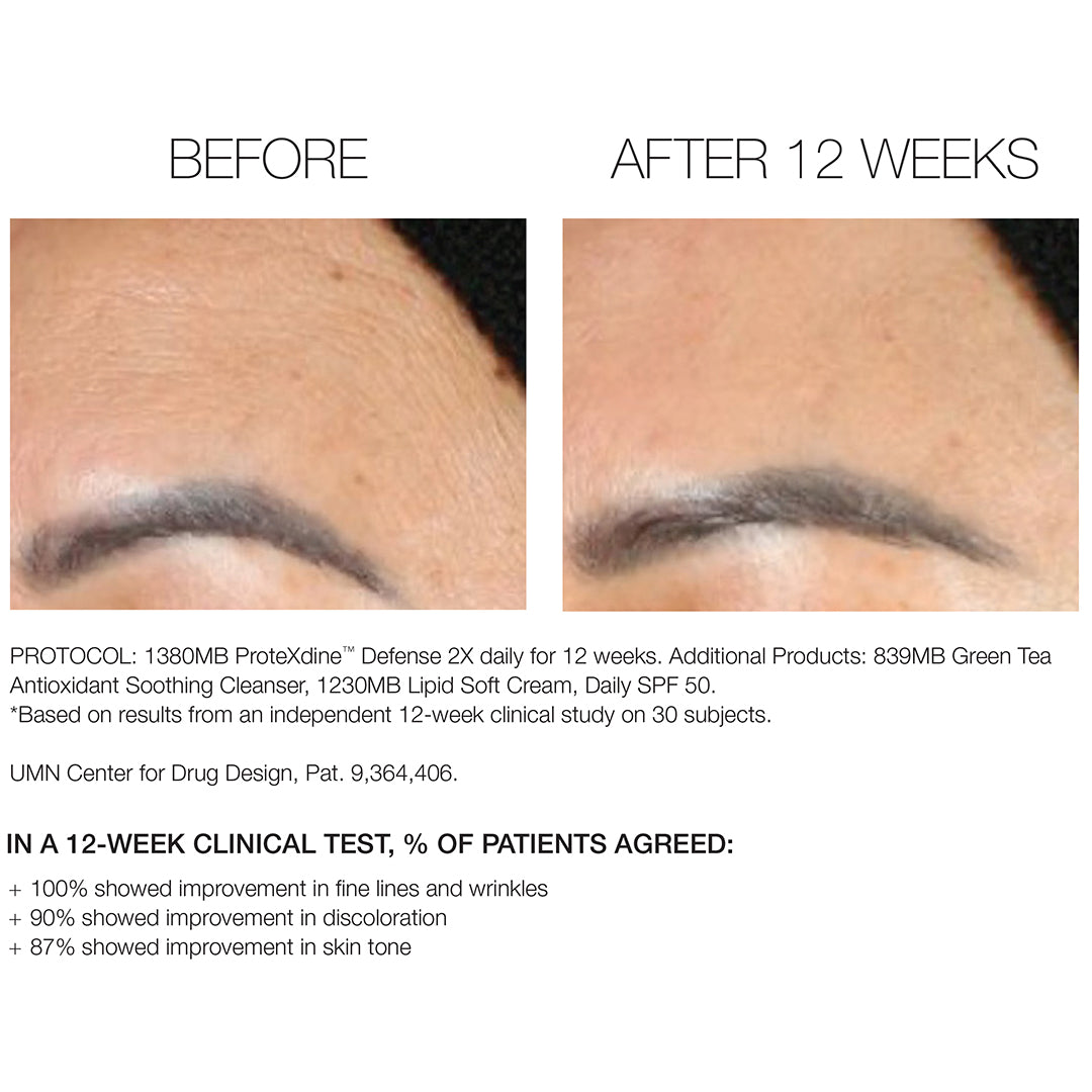 Barrier Defense Creme before and after photo