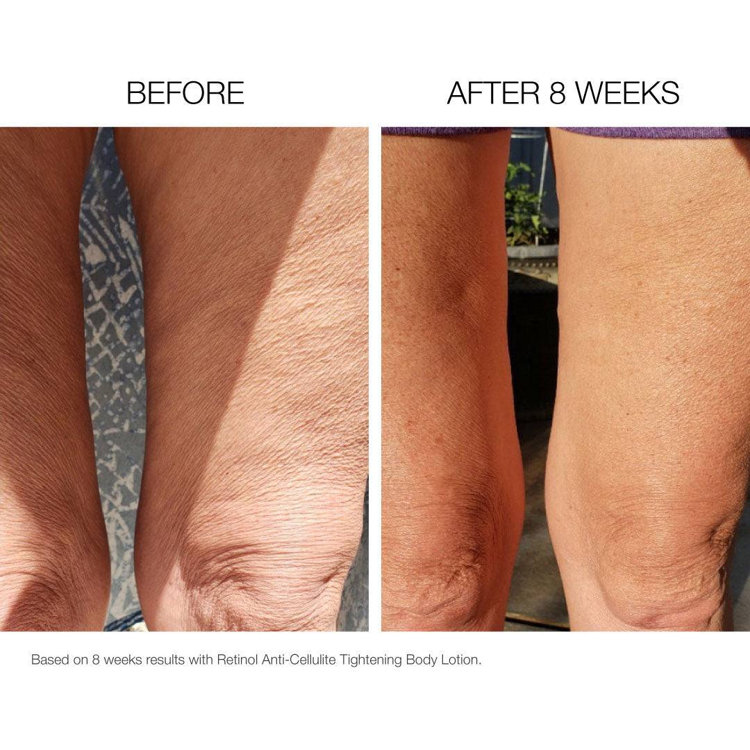 Body Anti-Aging Creme Before and After