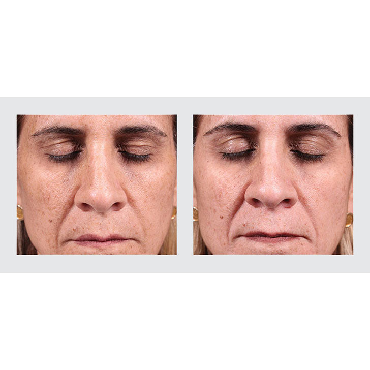 Brightening Creme before and after photos
