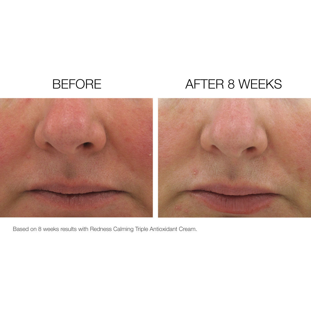 Calming Serum Before and After photos