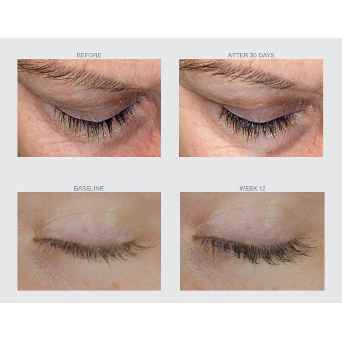 Lash Enhancement before and after photos
