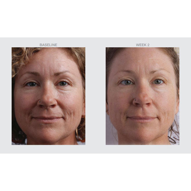 Return to Firm before and after photos
